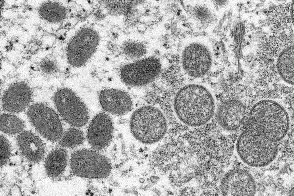 OMS: pas de pandémie de variole simienne, mais…