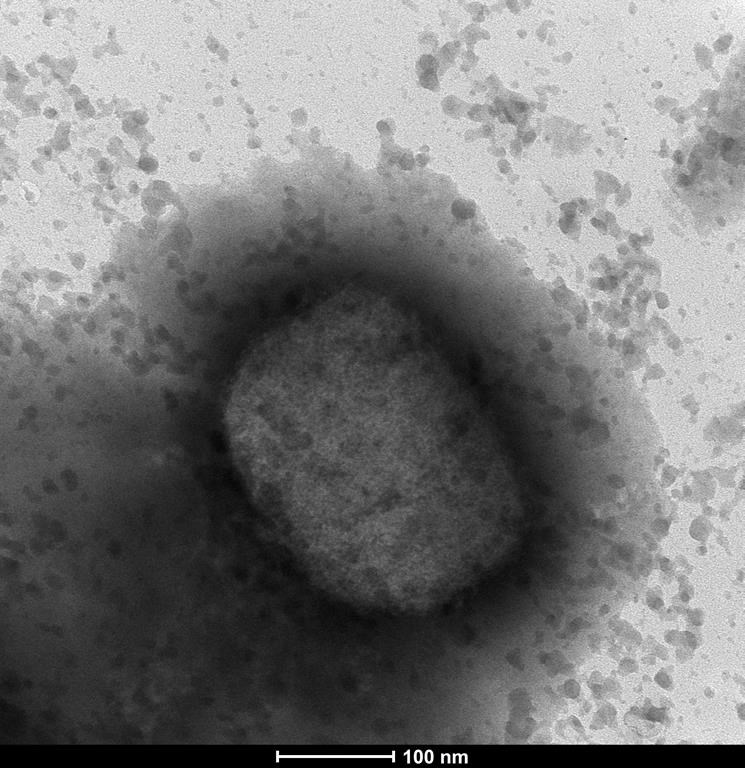 Le nombre de cas confirmés de variole simienne atteint maintenant 90 au Québec