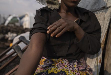 Épidémie de variole simienne en Afrique: «il peut y avoir des débordements au Canada»