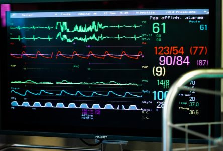 L’intelligence artificielle pourrait détecter la fibrillation auriculaire