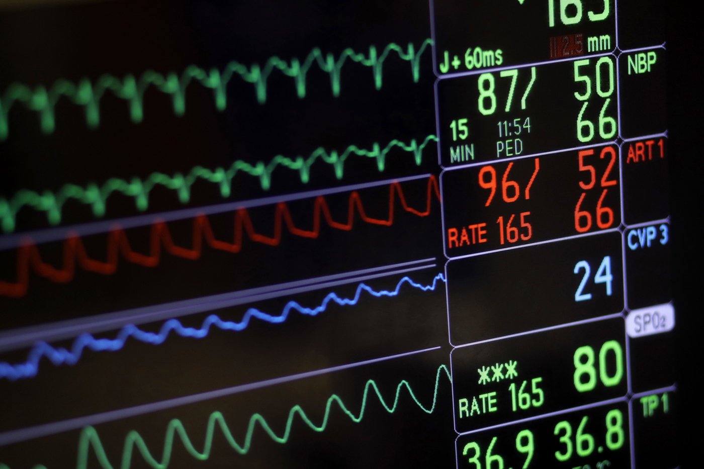 Le taux de mortalité des maladies du cœur et AVC a reculé au Canada